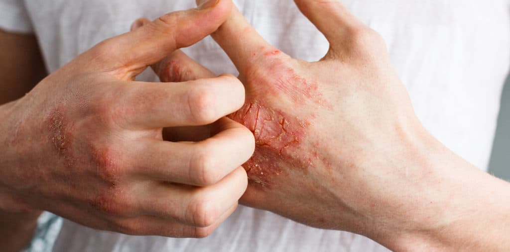 Relieving Signs of Skin Problems